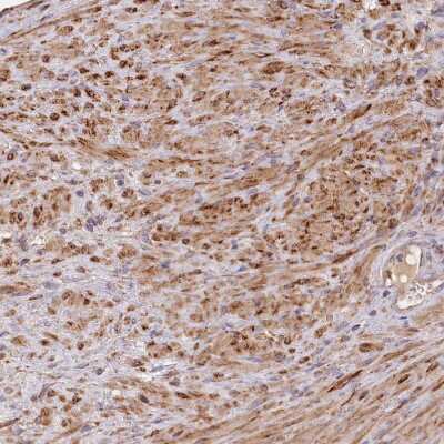 Immunohistochemistry-Paraffin: FUNDC1 Antibody [NBP1-81063]