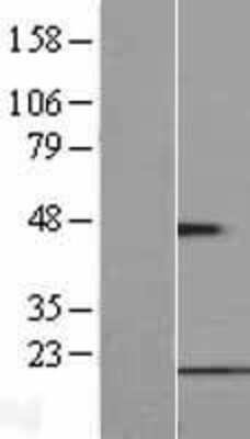Western Blot: FUNDC1 Overexpression Lysate [NBL1-10858]