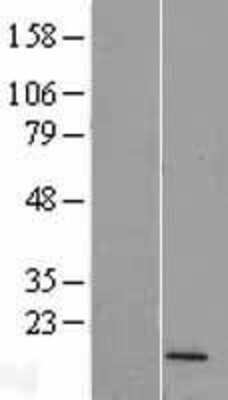 Western Blot: FUNDC2P2 Overexpression Lysate [NBL1-12598]