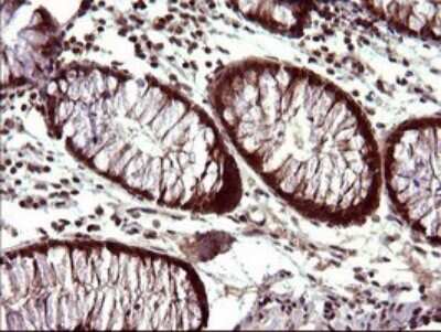 Immunohistochemistry: FUR1 Antibody (OTI2D1) [NBP2-46297]