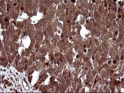 Immunohistochemistry: FUR1 Antibody (OTI2D1) [NBP2-46297]