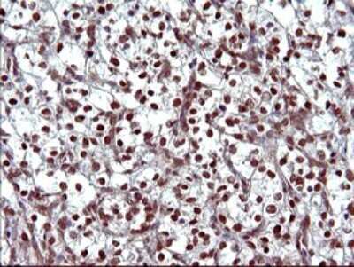 Immunohistochemistry: FUR1 Antibody (OTI2D1) [NBP2-46297]