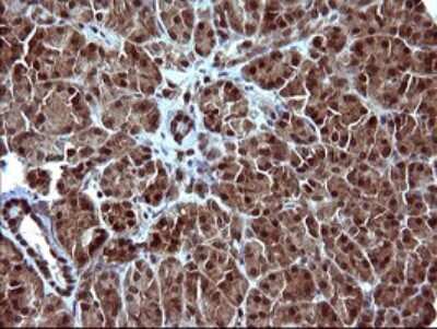 Immunohistochemistry: FUR1 Antibody (OTI2D1) [NBP2-46297]