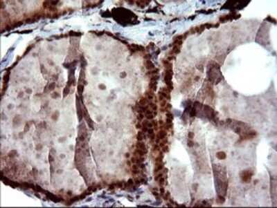 Immunohistochemistry: FUR1 Antibody (OTI2D1) [NBP2-46297]
