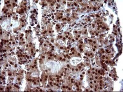 Immunohistochemistry: FUR1 Antibody (OTI2D1) [NBP2-46297]
