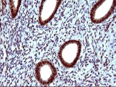 Immunohistochemistry: FUR1 Antibody (OTI2D1) [NBP2-46297]