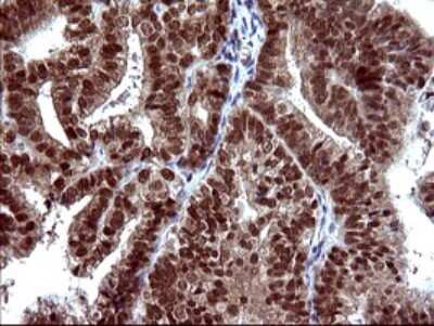 Immunohistochemistry: FUR1 Antibody (OTI2D1) [NBP2-46297]