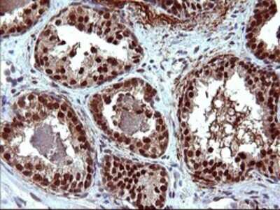 Immunohistochemistry: FUR1 Antibody (OTI2D1) [NBP2-46297]