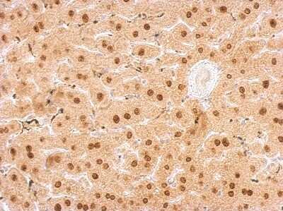 Immunohistochemistry-Paraffin: FUR1 Antibody [NBP2-16547]