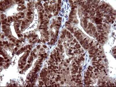 Immunohistochemistry: FUR1 Antibody (OTI2D1) - Azide and BSA Free [NBP2-72399]