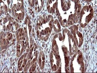 Immunohistochemistry: FUR1 Antibody (OTI2D1) - Azide and BSA Free [NBP2-72399]
