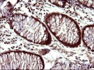 Immunohistochemistry: FUR1 Antibody (OTI2D1) - Azide and BSA Free [NBP2-72399]