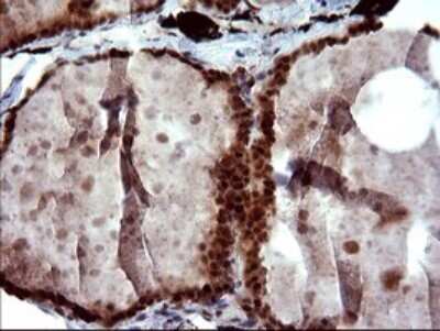 Immunohistochemistry: FUR1 Antibody (OTI2D1) - Azide and BSA Free [NBP2-72399]