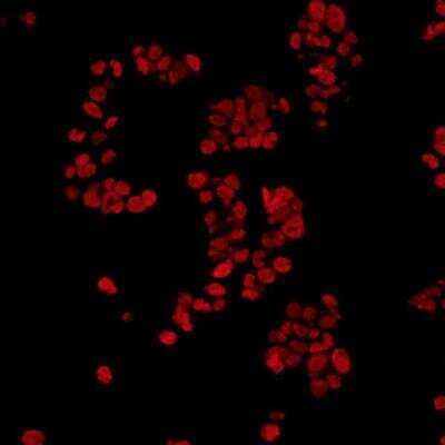 Immunocytochemistry/ Immunofluorescence: FUS Antibody (BLR023E) [NBP2-76415]