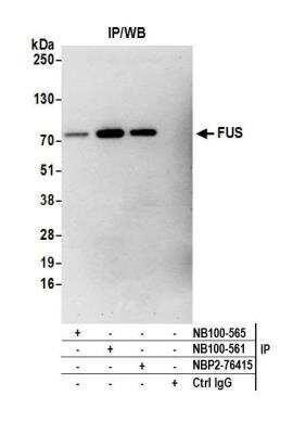 Immunoprecipitation: FUS Antibody (BLR023E) [NBP2-76415]