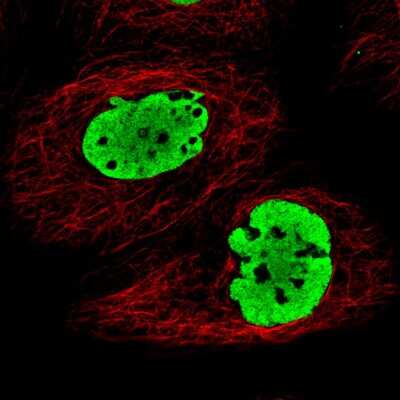 Immunocytochemistry/ Immunofluorescence: FUS Antibody (CL0190) [NBP2-52874]
