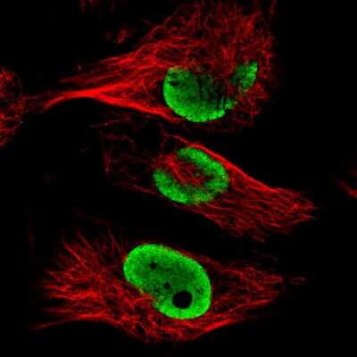 Immunocytochemistry/ Immunofluorescence: FUS Antibody (CL0190) [NBP2-52874]