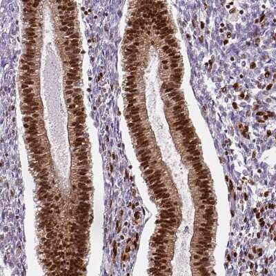 Immunohistochemistry-Paraffin: FUS Antibody (CL0190) [NBP2-52874]