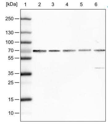 Western Blot: FUS Antibody (CL0190) [NBP2-52874]