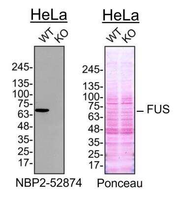 Knockout Validated: FUS Antibody (CL0190) [NBP2-52874]