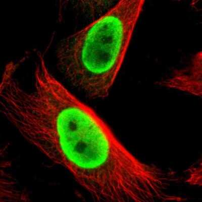Immunocytochemistry/ Immunofluorescence: FUS Antibody [NBP1-89113]