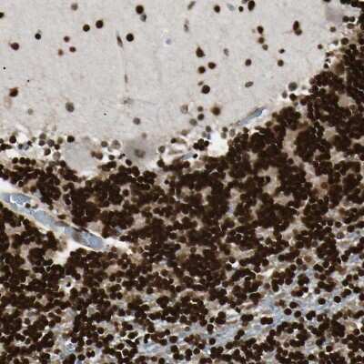 Immunohistochemistry-Paraffin: FUS Antibody [NBP1-89113]
