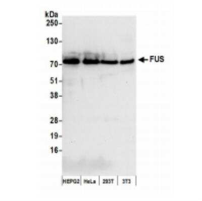 Western Blot: FUS Antibody [NB100-565]