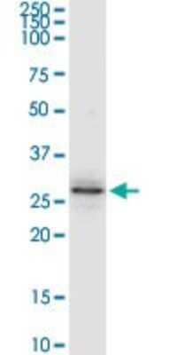 Western Blot: FUS2 Antibody [H00024142-D01P]