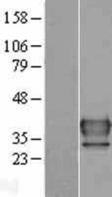 Western Blot: FUS2 Overexpression Lysate [NBL1-13490]
