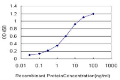 ELISA: FUSIP1 Antibody (1A6) [H00010772-M03]