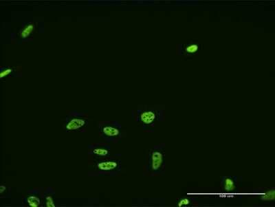 Immunocytochemistry/ Immunofluorescence: FUSIP1 Antibody (1G11) [H00010772-M07]