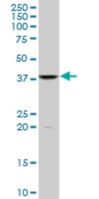 Western Blot: FUSIP1 Antibody (1G11) [H00010772-M07]