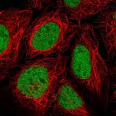 Immunocytochemistry/ Immunofluorescence: FUSIP1 Antibody [NBP2-46818]