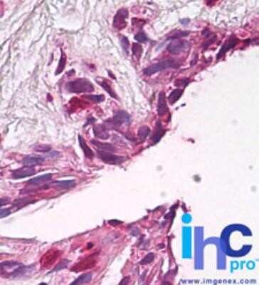 Immunohistochemistry-Paraffin: FUZ Antibody - Azide Free [NBP2-33260]
