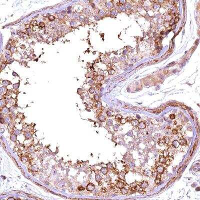Immunohistochemistry: FUZ Antibody [NBP1-82111]
