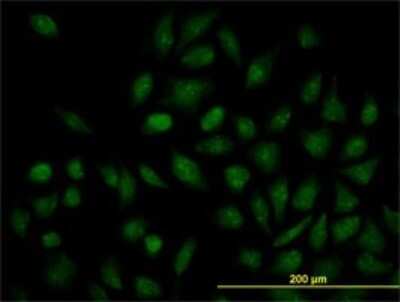Immunocytochemistry/ Immunofluorescence: FXR/NR1H4 Antibody (1B10) [H00009971-M02]