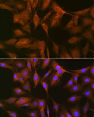 Immunocytochemistry/ Immunofluorescence: FXR1 Antibody (2S2B1) [NBP3-16681]