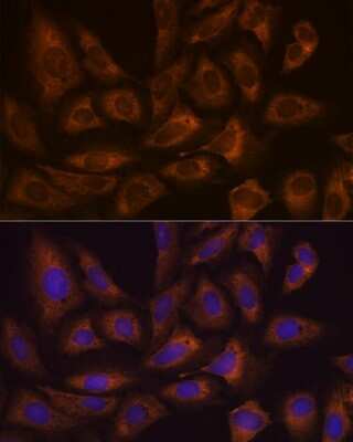 Immunocytochemistry/ Immunofluorescence: FXR1 Antibody (2S2B1) [NBP3-16681]