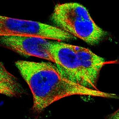 Immunocytochemistry/ Immunofluorescence: FXR2 Antibody [NBP1-83432]