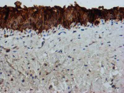 Immunohistochemistry-Paraffin: FXYD3 Antibody (OTI4E3) [NBP2-01991]