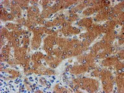 Immunohistochemistry-Paraffin: FXYD3 Antibody (OTI4E3) [NBP2-01991]