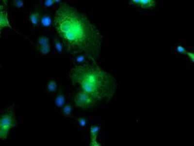 Immunocytochemistry/ Immunofluorescence: FXYD3 Antibody (OTI4E3) - Azide and BSA Free [NBP2-71219]