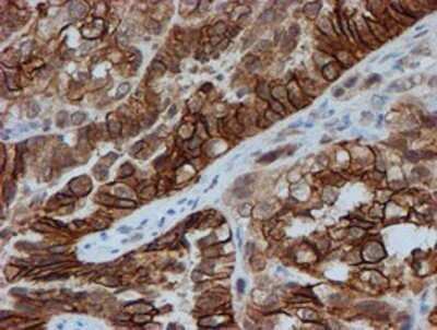 Immunohistochemistry: FXYD3 Antibody (OTI4E3) - Azide and BSA Free [NBP2-71219]