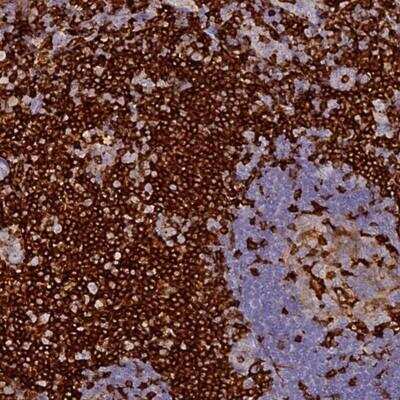 Immunohistochemistry: FYB/ADAP/SLAP130 Antibody [NBP1-91916]