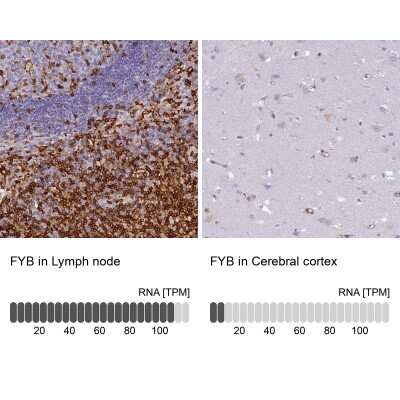Immunohistochemistry-Paraffin: FYB/ADAP/SLAP130 Antibody [NBP1-91916]