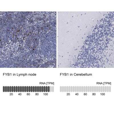 Immunohistochemistry-Paraffin: FYB/ADAP/SLAP130 Antibody [NBP3-16998]
