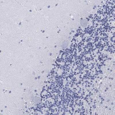 Immunohistochemistry-Paraffin: FYB/ADAP/SLAP130 Antibody [NBP3-16998]