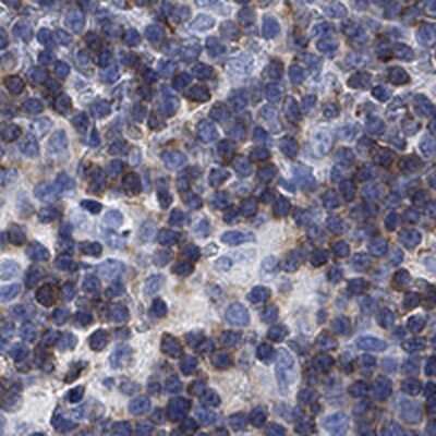 Immunohistochemistry-Paraffin: FYB/ADAP/SLAP130 Antibody [NBP3-16998]