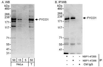 Western Blot: FYCO1 Antibody [NBP1-47265]