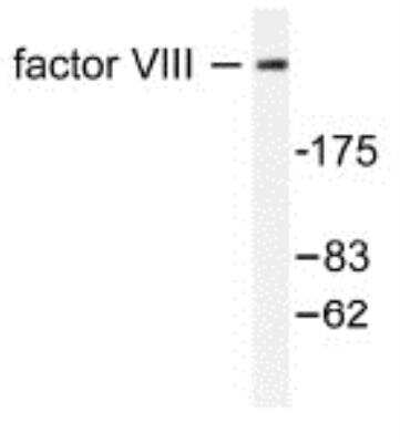 Western Blot: Factor VIII AntibodyBSA Free [NB100-91761]